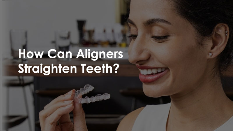 Invisalign Etobicoke ON - Clear Teeth Aligners